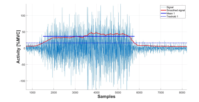 Surface electromyography